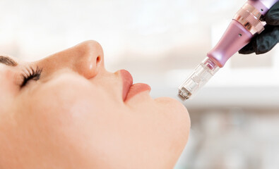 Beauty treatment and professional cosmetology. Rejuvenation procedure of fractional mesotherapy of...