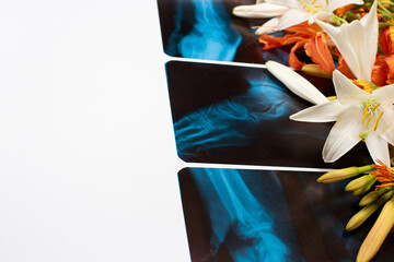 Greeting card with flowers and X-rays for the day of the traumatologist, radiologist, osteopath...