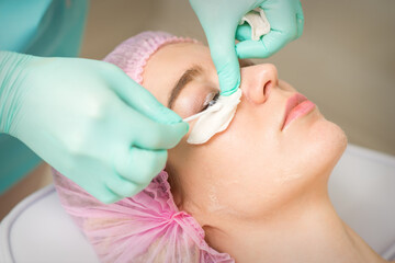 Young woman receiving eyelash removal procedure and removes mascara with a cotton swab and stick in...