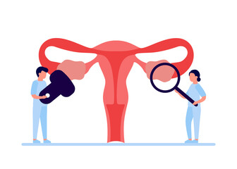 Doctor checkup reproductive system of woman. Health and disease uterus and ovary internal organ. Polycystic ovary syndrome, inflammation, pain. Vector illustration - obrazy, fototapety, plakaty