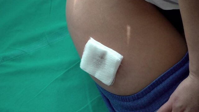 First aid hospital make desinfection with betadine of woman's leg with a dog bite wound