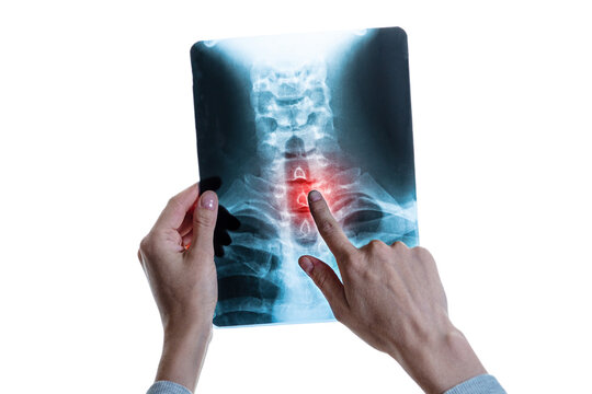 X-ray image of vertebral column with red pain point in cervical spine
