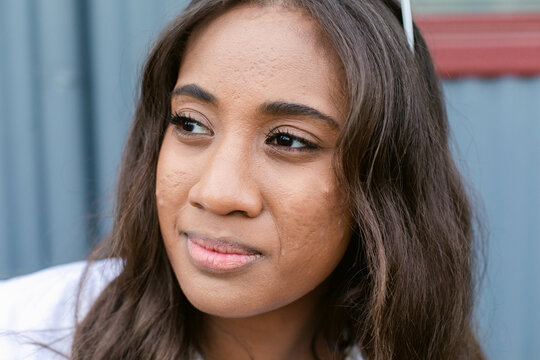 Young Fijian female with acne looking away