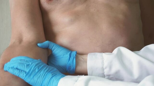 A doctor in blue rubber gloves and a white lab coat examines and palpates a man with lipomas - benign tumors on the body. multiple lipomas