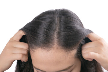 Young Asian women worry about problem hair loss,head bald,dandruff.hair loss problem and Hair...
