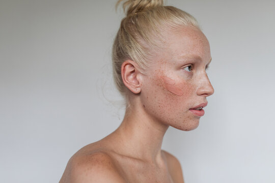 Freckled model with clay mask on her face