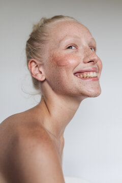 Freckled model with clay mask smiling