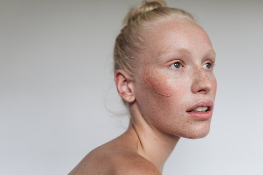 Freckled model with clay mask
