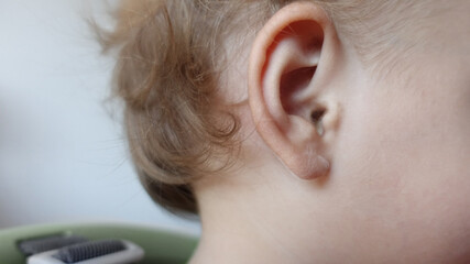 Close up on a toddler's ear. Concept of deafness, hearing problem, disorder and defect. Soft focus on young girl's ear.