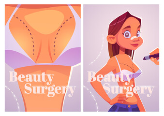 Beauty surgery cartoon posters. Woman with patch on nose prepare for plastic surgery. Doctor drawing lines on girl chest for augmentation, lipofilling cosmetics medicine procedure Vector illustration