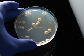 Close up of man holding a petri dish with microbe colony, growing mold