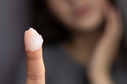 Closeup of a woman applying petroleum jelly to her face. Concept of slugging and skin care for dry, dehydrated skin.
