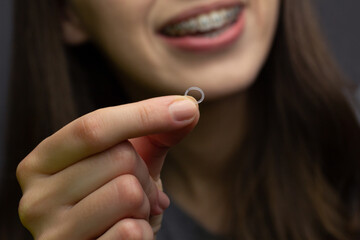 Closeup of a woman with braces wearing orthodontic elastics to correct her bite.