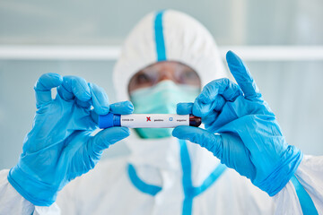 Scientist in the laboratory holds positive blood sample