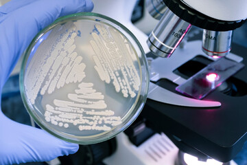 Scientist holds a petri dish with different pure cultures of bacteria on the background of a microscope in the laboratory.