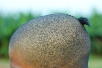 Close up view of mens head scalp