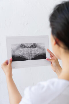 Concept dentistry. blur Doctor watches to black and white picture. From behind of Young woman dentist with black hair looks at snapshot of teeth. Vertical photo, story instagram with copyspace.