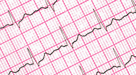 Cardiogram. Fragment of research result by CU