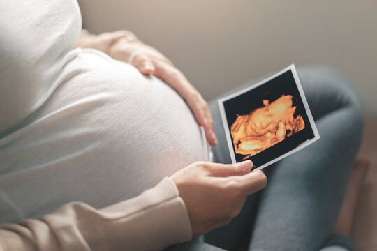 Asian pregnant woman holding ultrasound 4d scan image, Expectation of a child and Maternity prenatal care and woman pregnancy concept.