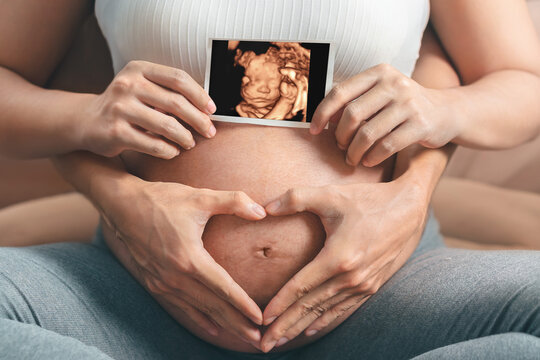 Asian pregnant woman and husband  holding hand together, holding ultrasound 4d scan image and making hand heart gesture on her belly,  Expectation of child and woman pregnancy concept.