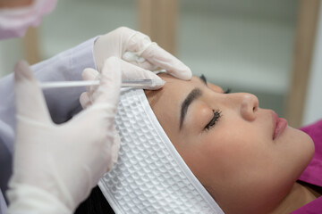 woman receiving a botox injection