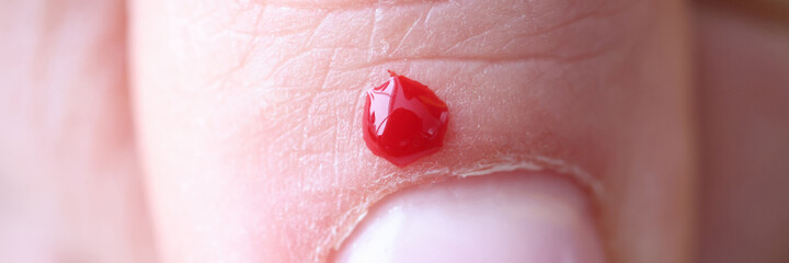 Fototapeta premium There is small wound with blood on finger