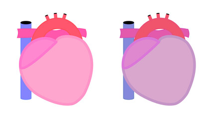 心臓のシンプルなイラスト。健康なものと不健康なものの二つ。