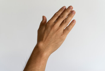 Ganglion cyst on man's hand on white background - obrazy, fototapety, plakaty