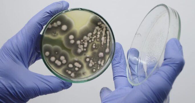 Close-up, a scientist opens a petri dish with his hands with bacteria, fungi that cause allergies in humans.