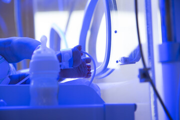 Karmienie noworodka w inkubatorze. Żółtaczka niemowlaków. Fototerapia - obrazy, fototapety, plakaty