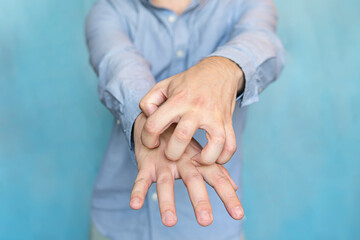 Man itchy hands on blue background. scabies on hands