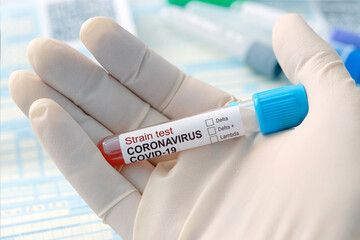Scientists or physicians analyze the blood sample to prepare a vaccine against a new strain of...