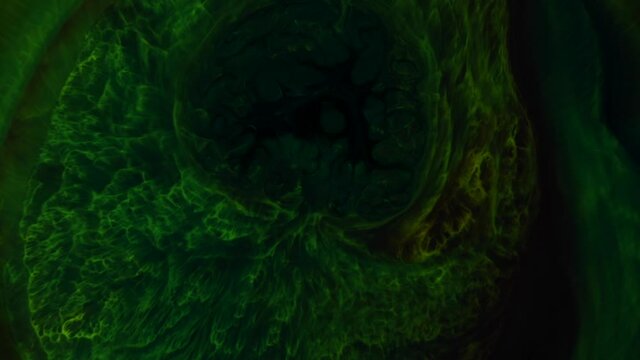 Ominous, pulsing dark-green expands and takes over, pushing  lovely lacy green away -  an all natural AbstractVideoClip