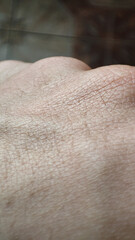 macro skin of human hand. Medicine and dermatology concept. healthy brown caucasian skin. Close up detail of skin