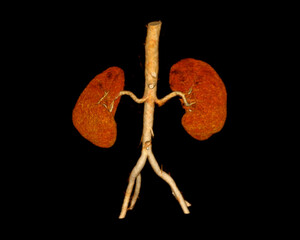 CTA Renal artery  3D rendering image  showing both kidney .