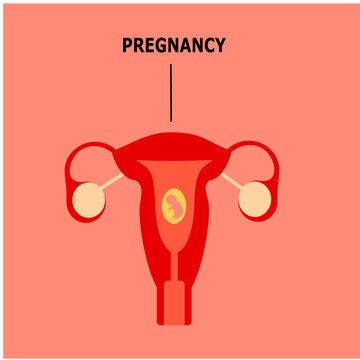 Vector illustration of a uterus with an embryo. Uterine pregnancy. Uterus. Early embryo. Female anatomy. The reproductive system of a woman. Uterus with ovaries.