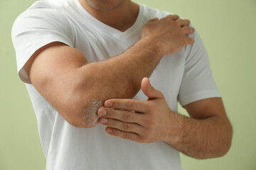 Man applying cream onto elbow on green background, closeup