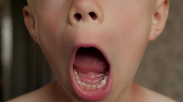 A close-up of a little boy shows his fallen out baby teeth.