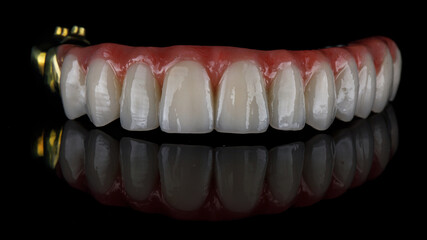 high quality ceramic denture of the upper jaw close-up on black glass