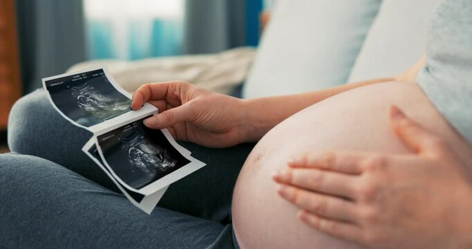 Shot from above with a view of a pregnant lady sitting on sofa, wearing sweatpants and short top, woman touches her large belly, puts hand on it, strokes it, compares photo taken during ultrasound