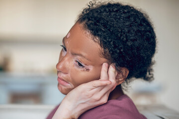 Young dark-skinned woman suffering from a headache