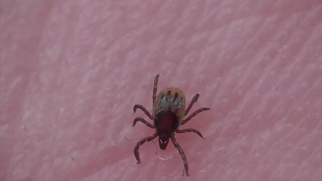 Zecke l&auml;uft &uuml;ber Haut
