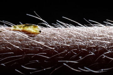 Micro insect larva on human hand, macro photo
