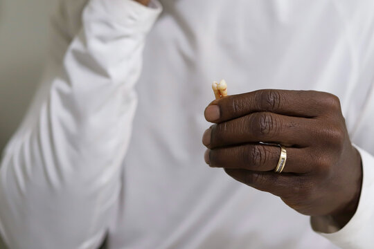 A Black African-American Man  Holding A Loose Tooth In His Hand