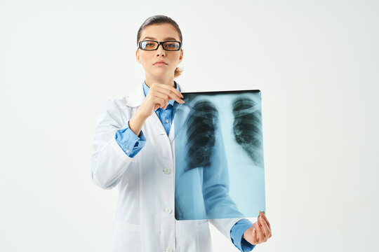 doctor x-ray in hand diagnostics hospital professionals