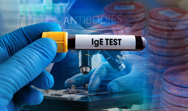 Background with plates with samples and a microscopist analyzing the sample in microscope. Blood sample tube for Immunoglobulin E antibody or IgE level test in blood for diagnosis allergic diseases
