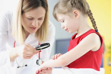 Doctor pediatrician examining rash on skin of hand of little girl using magnifying glass