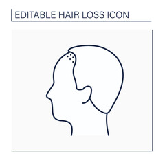 Hair loss line icon. Man loses hair above upper brow crease. Male pattern baldness. Alopecia concept. Isolated vector illustration. Editable stroke
