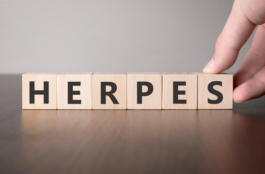 Hand flip wooden cube with word herpes. Medical concept