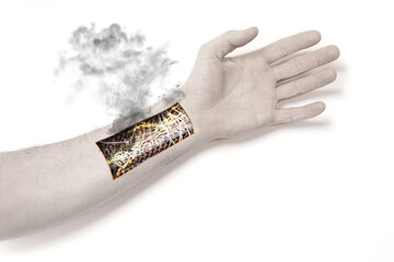 Robot hand inside human hand - Prosthesis concept, short cirquit